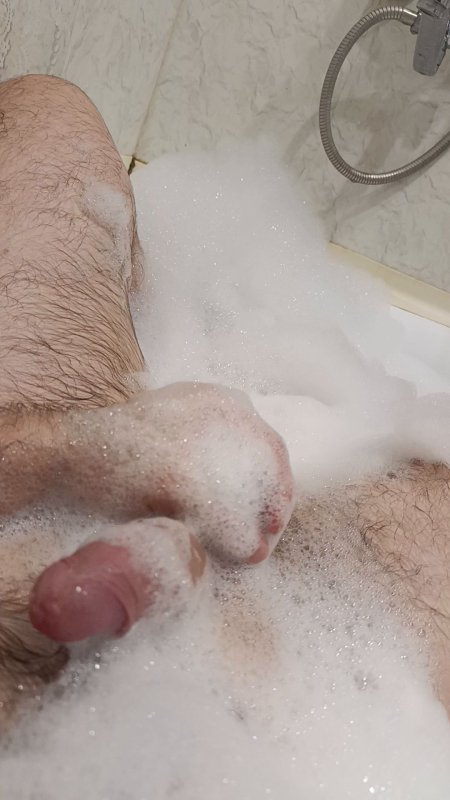 Kate Lilli — swollen vulva after hysterectomy (10:38) free vulva porn